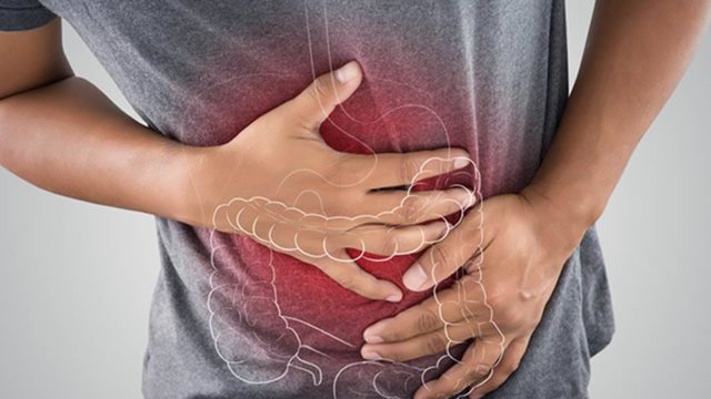 Bowel disease